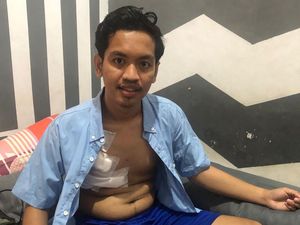 Suporter PSM Makassar Korban Pembusuran Sudah Pulih, Keluar RS Tanpa Biaya