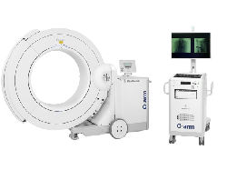 Tangani Skoliosis, Eka Hospital Hadirkan Teknologi Canggih O-Arm