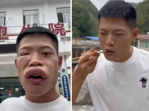 Sengaja Makan Lebah Agar Bibirnya Seksi, Influencer China Ini Dikecam Sengaja Makan Lebah Agar Bibirnya Seksi, Influencer China Ini Dikecam