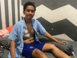 3 Kasus Busur Panah Makassar Selama September: Korban Suporter PSM-Mahasiswa