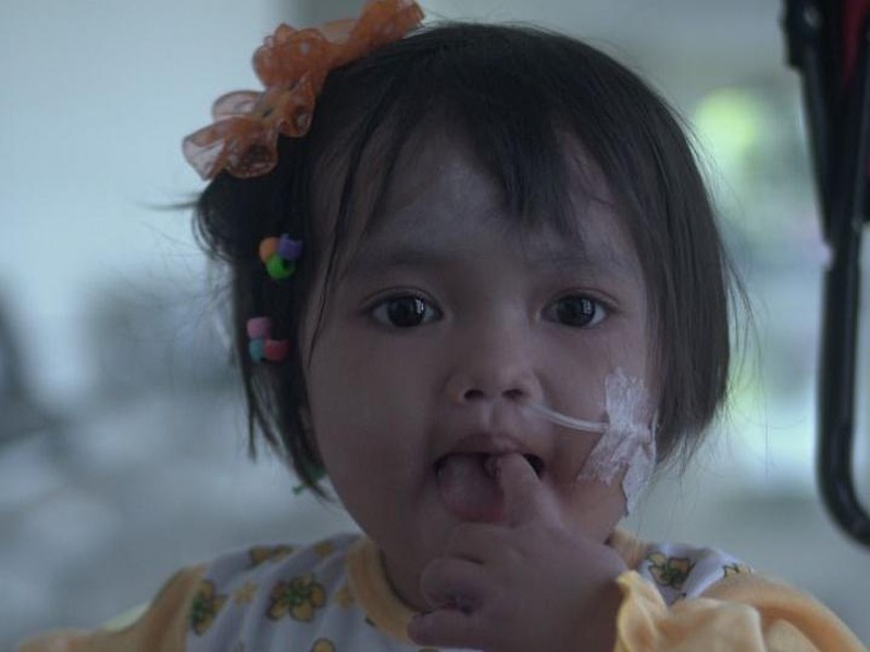 Cerita Eliza Berjuang Sembuh dari Epidermolisis Bullosa, Kamu Bisa Bantu