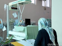 Bayi Kembar Siam 2 Kepala 1 Badan Lahir di Pariaman, Begini Kondisinya