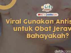 Viral Seleb TikTok Pakai Povidone Iodine ke Wajah, Amankah?