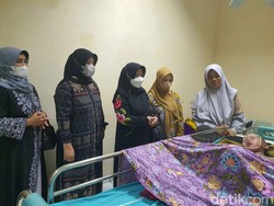 Kulit Bocah Ciamis Menyerupai Sisik gegara Autoimun