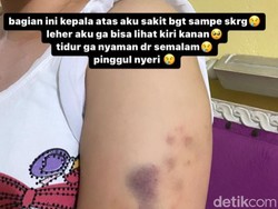 9 Anggota BNN Riau Diperiksa Kasus Polwan Aniaya Wanita di Pekanbaru