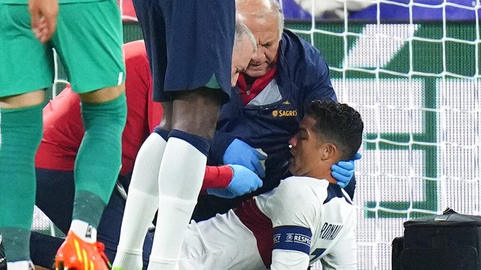 Potret Cristiano Ronaldo Berdarah-darah Saat Portugal Hadapi Ceko Portugal's Cristiano Ronaldo is treated on the pitch during the UEFA Nations League soccer match between the Czech Republic and Portugal at the Sinobo stadium in Prague, Czech Republic, Saturday, Sept. 24, 2022. (AP Photo/Petr David Josek)