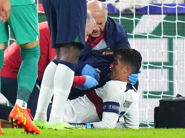 Potret Cristiano Ronaldo Berdarah-darah