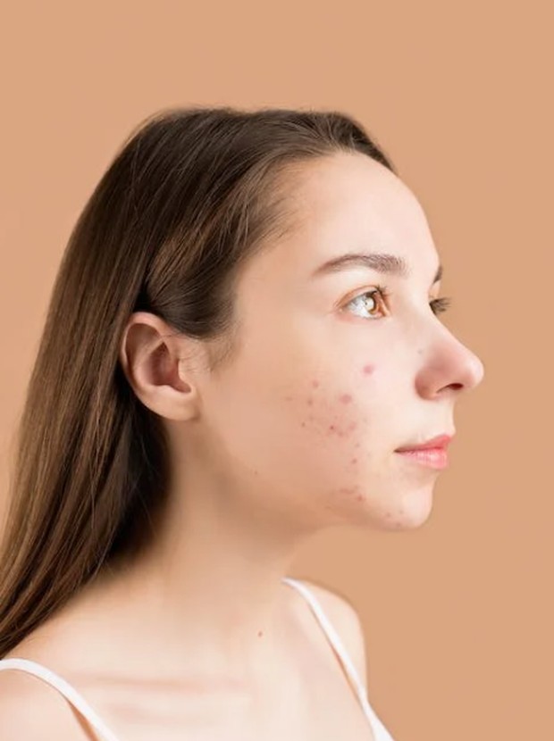 Melindungi Kulit Wajah dari Radikal Bebas