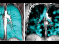 Vapers Sering Engap Saat Bernapas? Studi Temukan Kemungkinan Penyebabnya