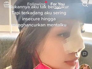 Cerita Wanita Tulungagung yang Foto Before After Oplas Viral Bikin Kaget