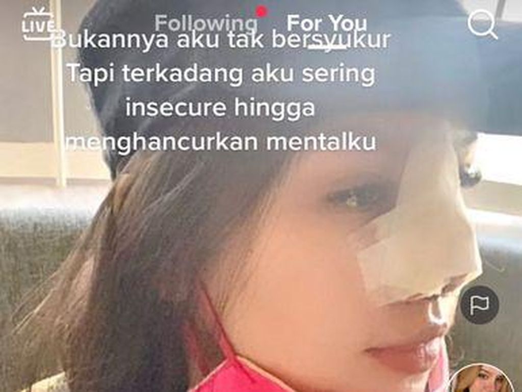 Cerita Wanita Tulungagung yang Foto Before After Oplas Viral Bikin Kaget Cerita Wanita Tulungagung yang Foto Before After Oplas Viral Bikin Kaget