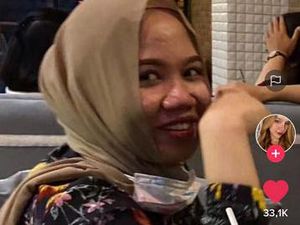 Viral Transformasi Wanita RI yang Operasi Plastik, Before After Bikin Kaget