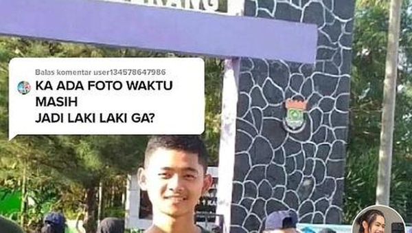 8 Foto Transformasi Pria Viral Dulu Taruna Kini Taruni, Bikin Shock