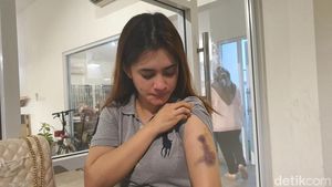 Foto-foto Bekas Luka Korban Usai Disekap-Dianiaya Oknum Polwan