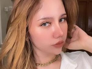 Wanita Tulungagung Oplas gegara Sering Di-bully, Kini Penampilannya Glowing