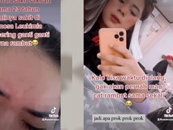 Viral Kisah Wanita Bogor 23 Tahun Idap Leukemia gegara Hobi Cat Rambut