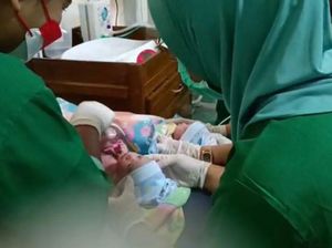 Bayi Kembar 3 Lahir Selamat di Pangkalpinang