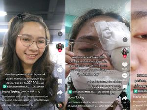 Viral Wanita Jakut Bintitan Sampai Harus Operasi, Ternyata Kena Penyakit Ini