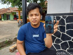 Tolong! Bayi Kembar Siam Asal Subang Butuh Bantuan untuk Operasi