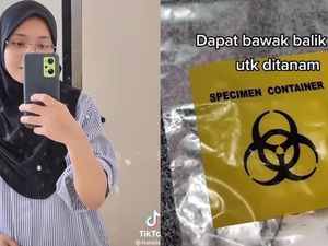 Viral Wanita 21 Tahun Nekat Cabut 4 Gigi Bungsu Sekaligus, Begini Pengalamannya Viral Wanita 21 Tahun Nekat Cabut 4 Gigi Bungsu Sekaligus, Begini Pengalamannya