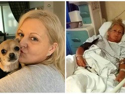 Wanita Ini Dirawat di RS Gegara Anjing Peliharaan BAB di Wajahnya