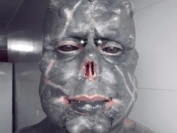 Ngeri Banget, Penggila Modifikasi Tubuh Ini Sengaja Potong Hidung dan Jari