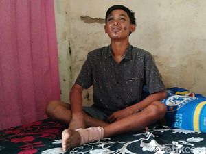 Kisah Pilu Pemuda Aremania, Korban Luka Parah Tragedi Kanjuruhan