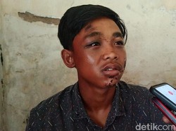 Kisah-kisah Nyesek Korban Kanjuruhan: Wajah Melepuh, Kaki Patah-Cari Utangan