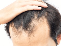 Manfaat Amino Acid bagi Kulit Kepala yang Ada di Produk lavojoy