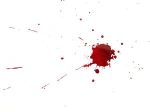 Pakaian Terkena Darah Haid, Bagaimana Cara Menyucikannya? Pakaian Terkena Darah Haid, Bagaimana Cara Menyucikannya?