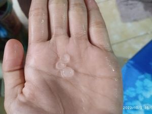 Depok Sempat Dilanda Hujan Es, BMKG Ungkap Pemicunya