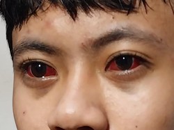 Penjelasan Polri soal 3 Jenis Gas Air Mata yang Dipakai Brimob