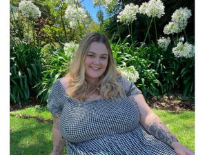 Wanita Kesakitan Punya Dada Ukuran JJ, Kini Payudaranya Diangkat Sampai 6 Kg