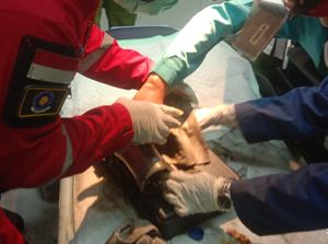 Duh! Jari Karyawati RSD Klaten Terjepit Gilingan Kacang