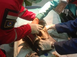 Duh! Jari Karyawati RSD Klaten Terjepit Gilingan Kacang