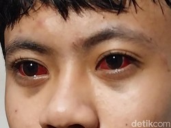 Komnas HAM Telusuri Dugaan Gas Air Mata Kedaluwarsa saat Tragedi Kanjuruhan