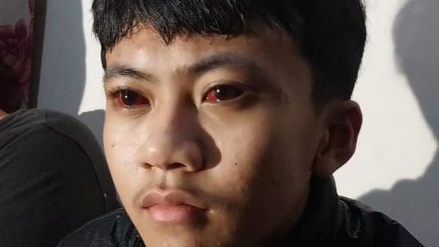 Korban selamat Tragedi Kanjuruhan Raffi Atha Dziaulhamdi (14) matanya memerah usai terkena tembakan gas air mata polisi. Detikcom Redaksi
