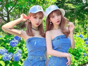 8 Foto Si Kembar yang Oplas Demi Tampil Identik, Foto Before-nya Beda Banget