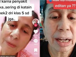 Viral Wanita di Bekasi Mengaku Idap Progeria, Sejak SD Sudah Seperti Nenek-nenek