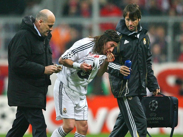 Munich, GERMANY: Real Madrid's Spanish defender Sergio Ramos bleeds as he is injuried during their Champions League football match against Bayern Munich at the Allianz Arena Stadium in Munich, 07 March 2007. AFP PHOTO/ PIERRE-PHILIPPE MARCOU (Photo credit should read PIERRE-PHILIPPE MARCOU/AFP via Getty Images)