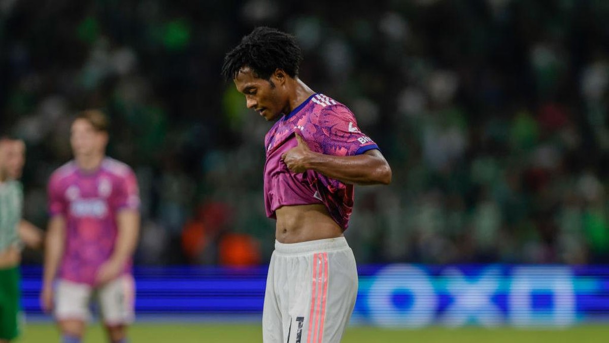 Juventus dipermalukan Maccabi Haifa. (Foto: Anadolu Agency via Getty Images/Anadolu Agency)