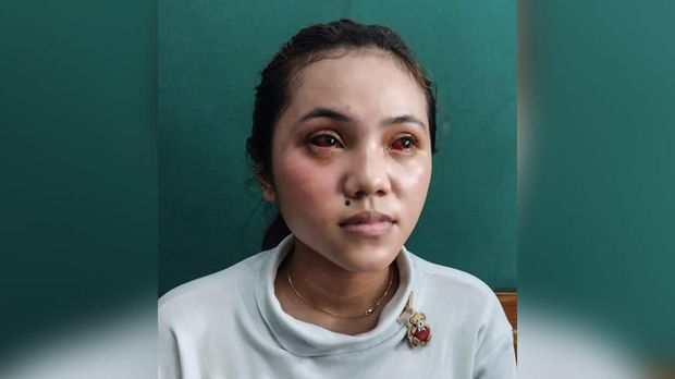 Kevia Naswa, korban tragedi kanjuruhan malang