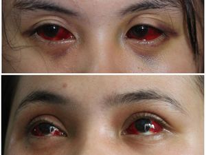 Tanda Mematikan di Selongsong Gas Air Mata Kanjuruhan Temuan KontraS