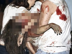 Trauma Mendalam Korban Bom Bali: Takut Nonton TV, Gemetar Lihat Ransel