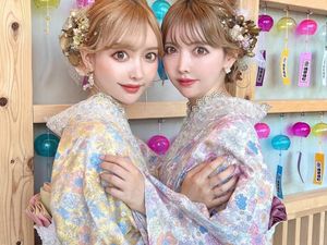 Viral Saudari Kembar Jalani Oplas Demi Identik 100 Persen, Begini Hasilnya Viral Saudari Kembar Jalani Oplas Demi Identik 100 Persen, Begini Hasilnya