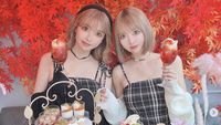 Viral Selebgram Kembar Hobi Operasi Plastik, Ternyata Juga Foodies
