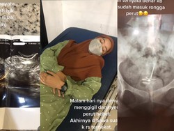 Viral Wanita Sumsel Ngeluh Nyeri Perut, Ternyata KB Pindah ke Perut