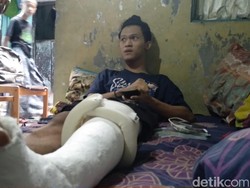 Gas Air Mata Jatuh di Depannya, Bagas Lari Tapi Kakinya Nyangkut Pagar