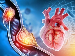 Kenali Jenis Otot Manusia dan Cara Kerjanya dalam Tubuh