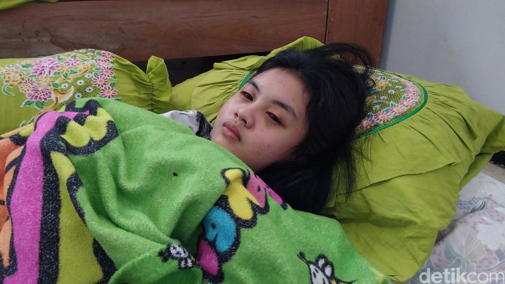 Cahayu, korban Tragedi Kanjuruhan yang sempat koma lalu hilang ingatan